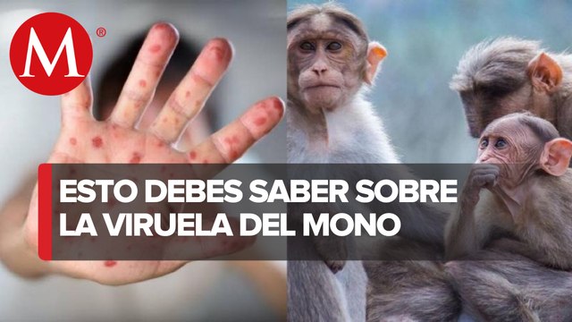 Viruela del mono: Qué es, cómo se contagia y cuáles son sus síntomas