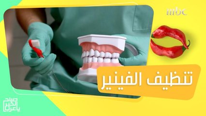 أهمية العناية وتنظيف الفينير بعد عملية التركيب