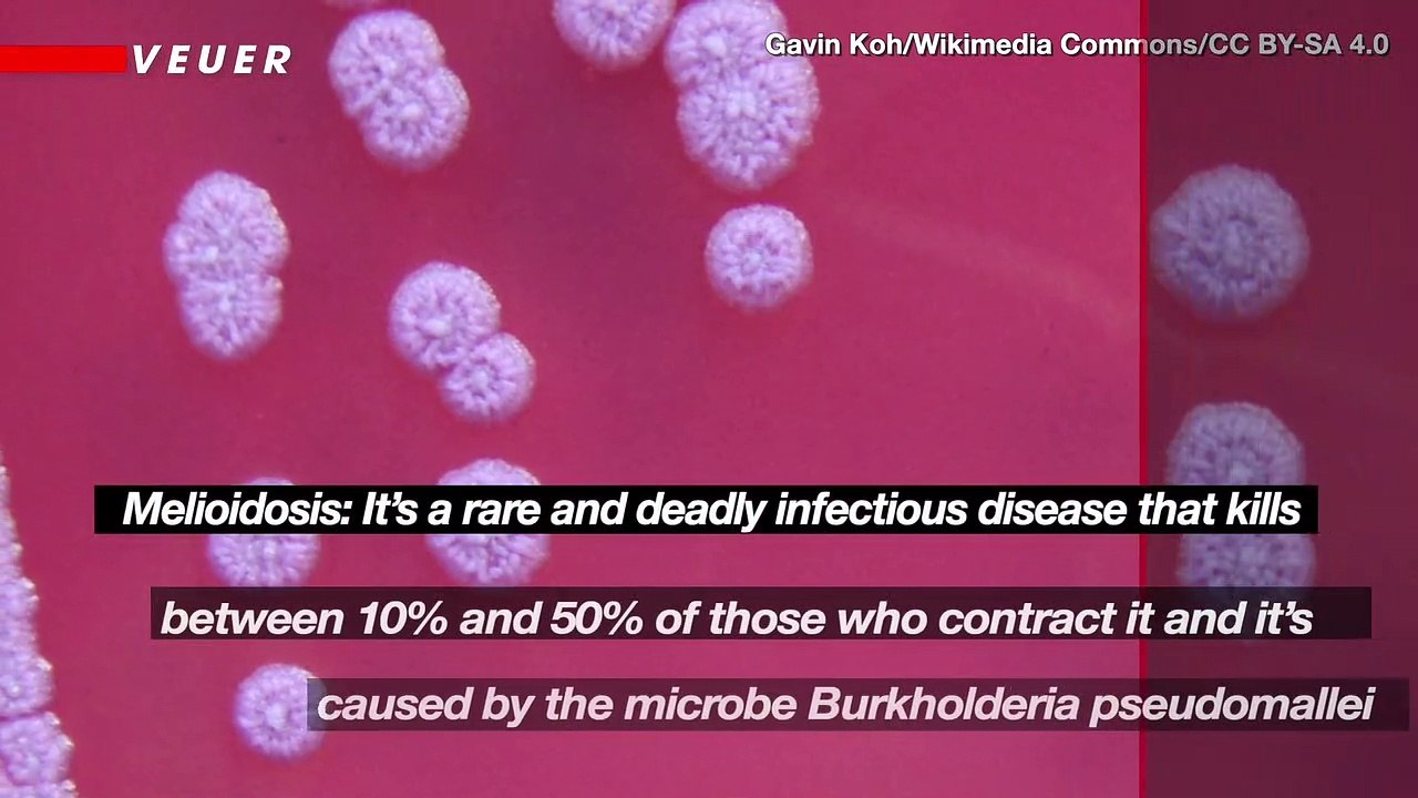 Deadly Bacteria Usually Only Found in the Tropics Might Be Growing in Mississippi Soil
