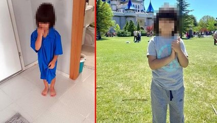 Yanlış sünnet edilen çocuğun hayatı karardı! 21 gündür su içmemek için direniyor