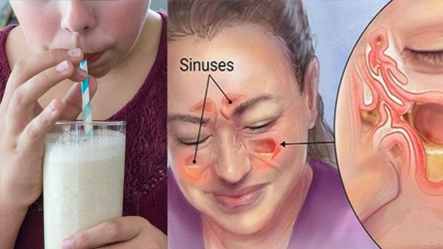 बनाना शेक पीने से क्या होता है ? | Banana Shake Pine Se Kya Hota Hai ? | Boldsky *Health