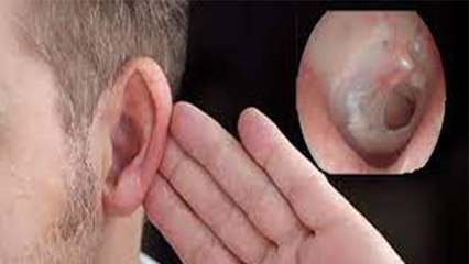 कान मे तेल डालना क्यों नही चाहिए ? | Kya Kaan me Tel Dalne Chaiye? | Boldsky *Health