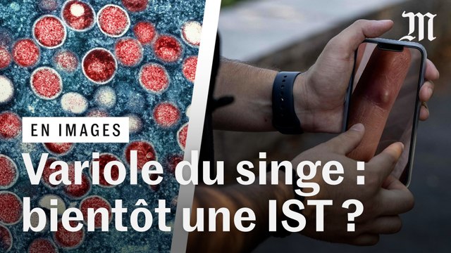 Variole du singe : comment les rapports sexuels entre hommes favorisent-ils la transmission ?