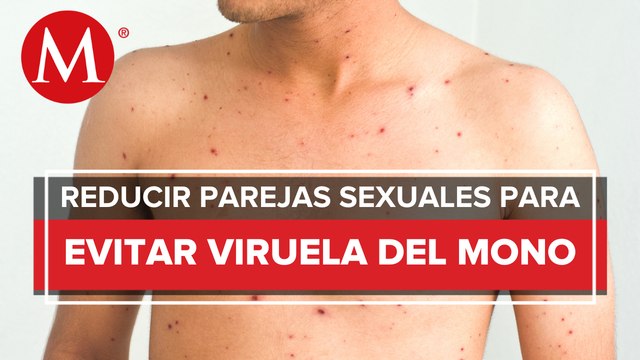 OMS llama a hombres a limitar número de parejas sexuales por viruela del mono