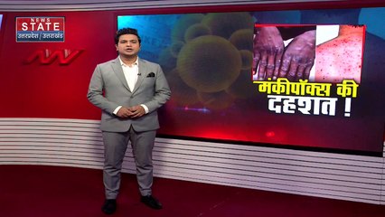 Uttar Pradesh : Kanpur में मंकीपॉक्स को लेकर मेडिसीन विभाग ने आयोजित की सेमिनार | UP News |
