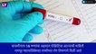 Swine Flu in Maharashtra: नागपुर मध्ये आढळले  Swine Flu चे 16 रुग्ण, प्रशासनाच्या चिंतेत वाढ