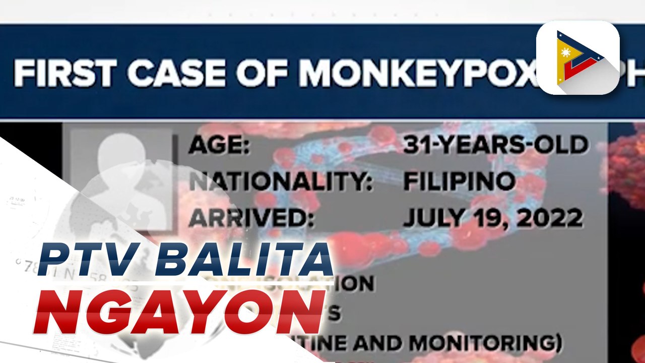 Unang kaso ng monkeypox sa bansa, kinumpirma ng DOH;