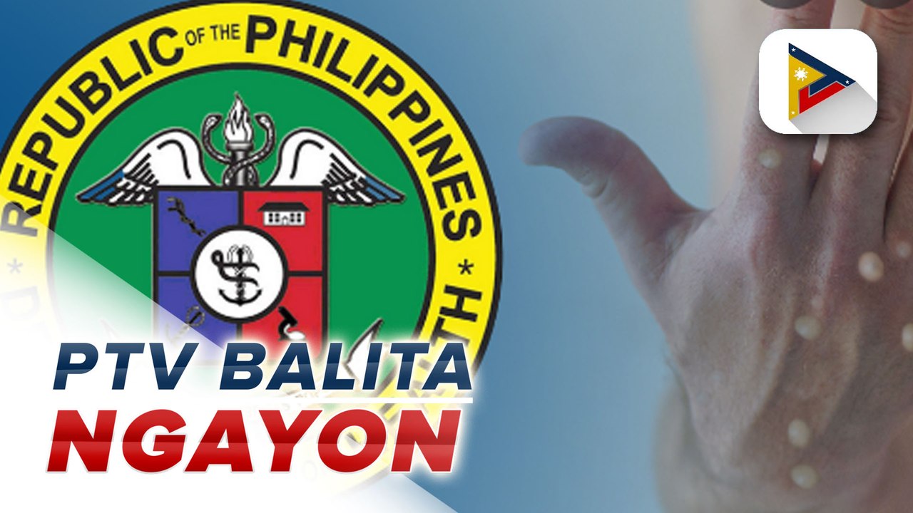 Unang kaso ng monkeypox sa bansa, kinumpirma ng DOH