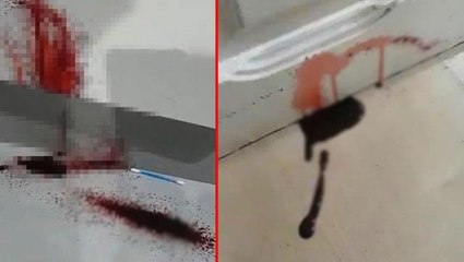 Yeni taşındıkları evin duvarlarından kan sızan aile, büyük panik yaşadı! Videosu olaydan daha ürkütücü