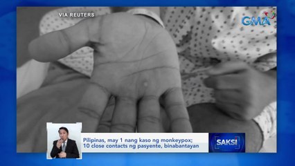 Pilipinas, may 1 nang kaso ng monkeypox; 10 close contacts ng pasyente, binabantayan | Saksi