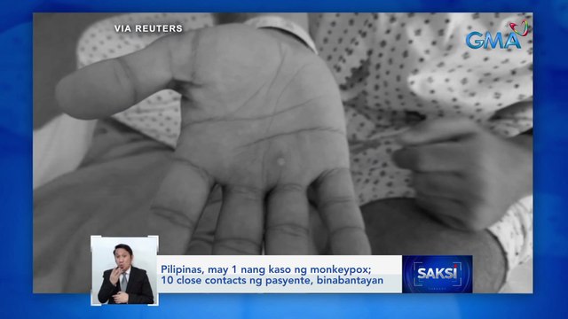 Pilipinas, may 1 nang kaso ng monkeypox; 10 close contacts ng pasyente, binabantayan | Saksi