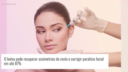 Tải video: Quem já teve paralisia facial pode fazer botox? Procedimento estético pode ajudar em tratamento, diz expert