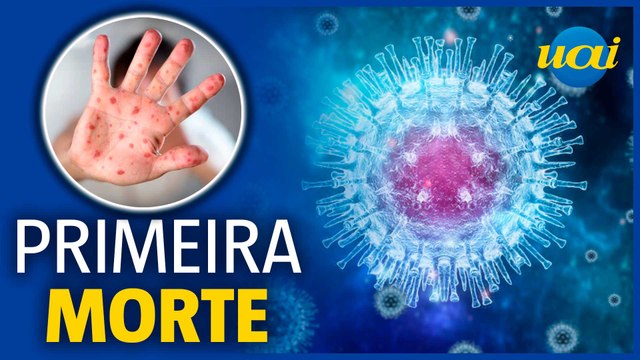 Brasil tem a 1ª morte por varíola dos macacos