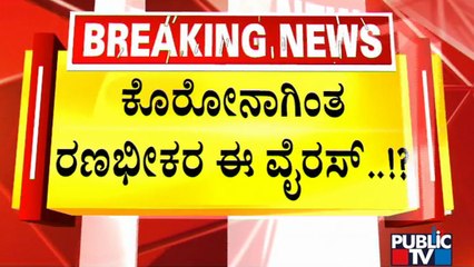 Monkeypox Suspect Case In Bengaluru | Public TV