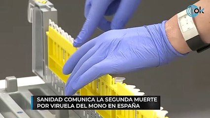 Sanidad comunica la segunda muerte por viruela del mono en España