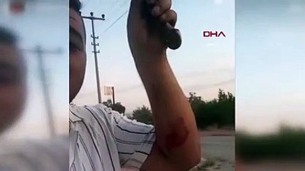 Eşini bıçaklayıp canlı yayın yaptı!