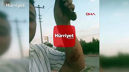 Eşini bıçakla yaralayıp, canlı yayın yaptı!