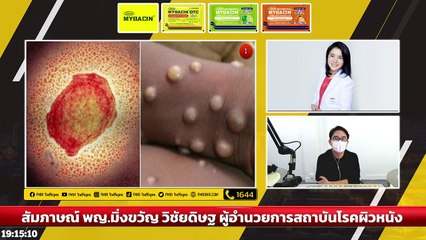 ไขข้อสงสัย โรคฝีดาษลิง? : DJ อยากแชร์ : 30 กรกฎาคม 2565