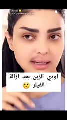 أودي الزين تفاجئ الجمهور بشكلها بدون فلتر بعد إزالة الفيلر