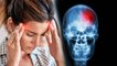 Cluster Headache क्या होता है | Cluster Headache Symptoms को न करें नजरंदाज |Boldsky*Health