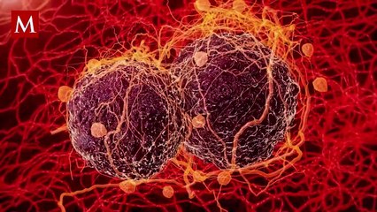 Científicos de Polonia descubren cáncer en momia egipcia embarazada