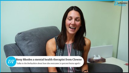 Roxy Rhodes suffered 70 percent burns aged 2