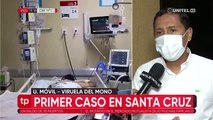 Tres personas están en observación por contacto con paciente confirmado con viruela del mono en Santa Cruz