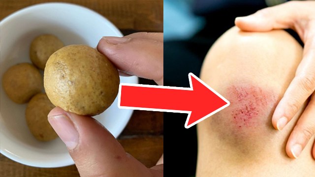 बेसन के लड्डू खाने से क्या होता है | Besan Ke Laddu Khane Se Kya Hota Hai | Boldsky *Health