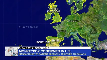 Maymun çiçeği virüsü yayılıyor