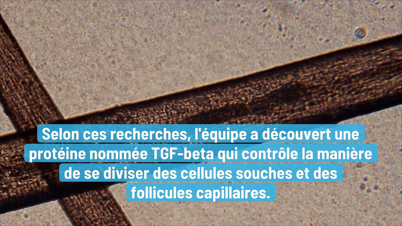 Une nouvelle étude explique d'où vient la perte de cheveux