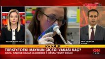 Bakan Koca: Türkiye'de 5 maymun çiçeği vakası tespit edildi