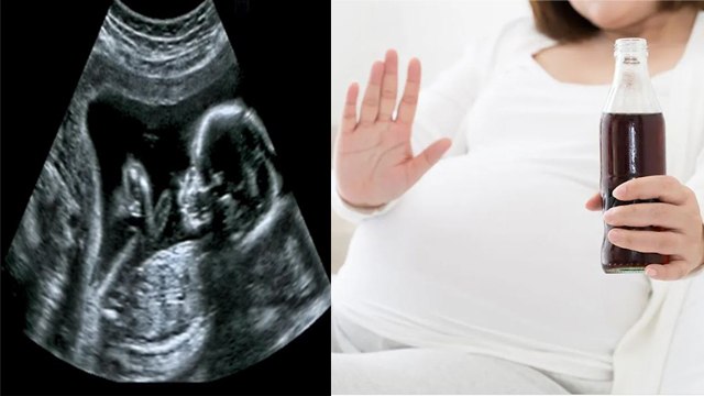 प्रेगनेंसी में कोल्ड ड्रिंक पीना चाहिए या नहीं ? Pregnancy me Cold Drink Pina Chahiye ya Nah *Health