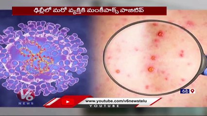 Download Video: Monkeypox Updates _Third monkeypox case Detected In Delhi  | V6 News (2)