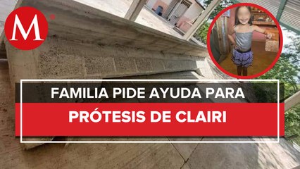 En Hidalgo, plancha de cemento le cayó encima a niña