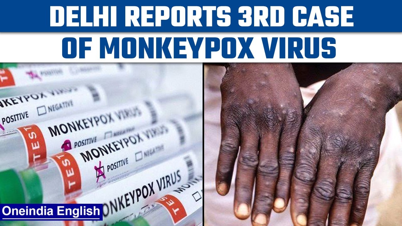 Monkeypox cases in Delhi rose to 3, total cases in India reach to 7 | Oneindia News *News
