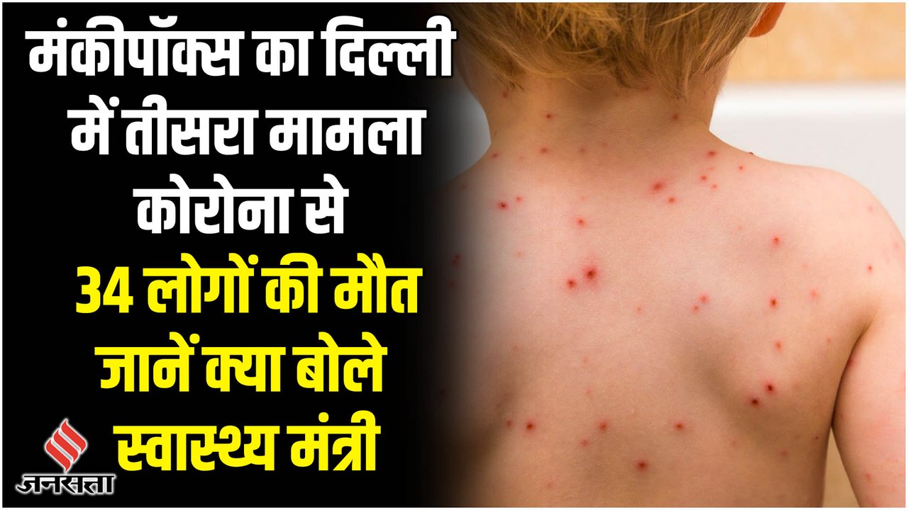 देश में Monkeypox संक्रमित मरीजों की संख्या 8, Corona पहुंचा 13 हजार पार, 34 लोगों की मौत