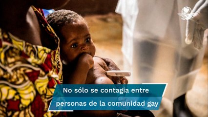 Conoce las formas en las que te puedes contagiar de viruela del mono, según la OMS