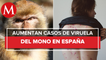 España supera los 4 mil casos de viruela del mono