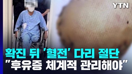 코로나19 확진 뒤 '혈전' 다리 절단..."후유증 체계적 관리 필요" / YTN