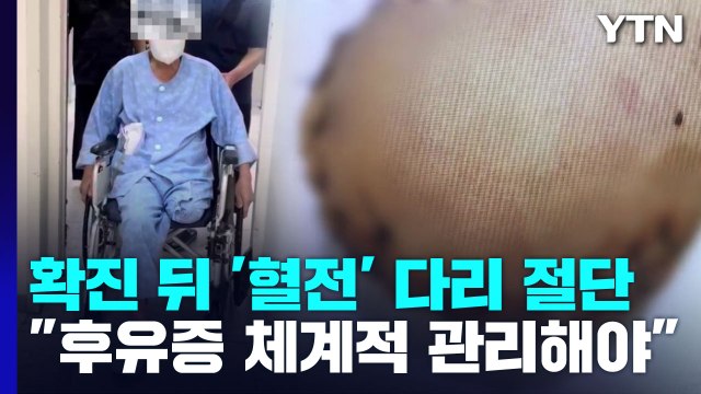 코로나19 확진 뒤 '혈전' 다리 절단... 후유증 체계적 관리 필요 / YTN