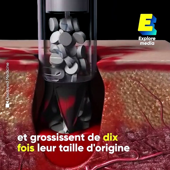 Cette seringue permet de stopper une hémorragie en moins de 20 secondes