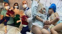 Conjoined Twins Brazil Seprated, Surgery Sucessful कैसे हुई | Boldsky*Health