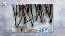 탈모 극복 후 활력 넘치는 일상을 사는 주인공 TV CHOSUN 20220807 방송