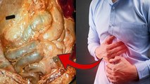 पेट में सूजन Peritonitis बीमारी का Symptoms | Peritonitis Kya Hai | Boldsky *Health
