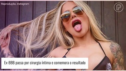 Ex-BBB faz cirurgia íntima e comemora resultado do procedimento. 'Está maravilhoso'