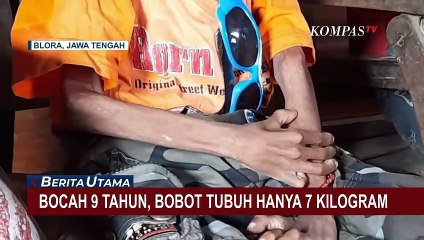 Menderita Penyakit Kronis Sejak Lahir, Bocah 9 Tahun di Blora Miliki Bobot Tubuh Hanya 7 Kg