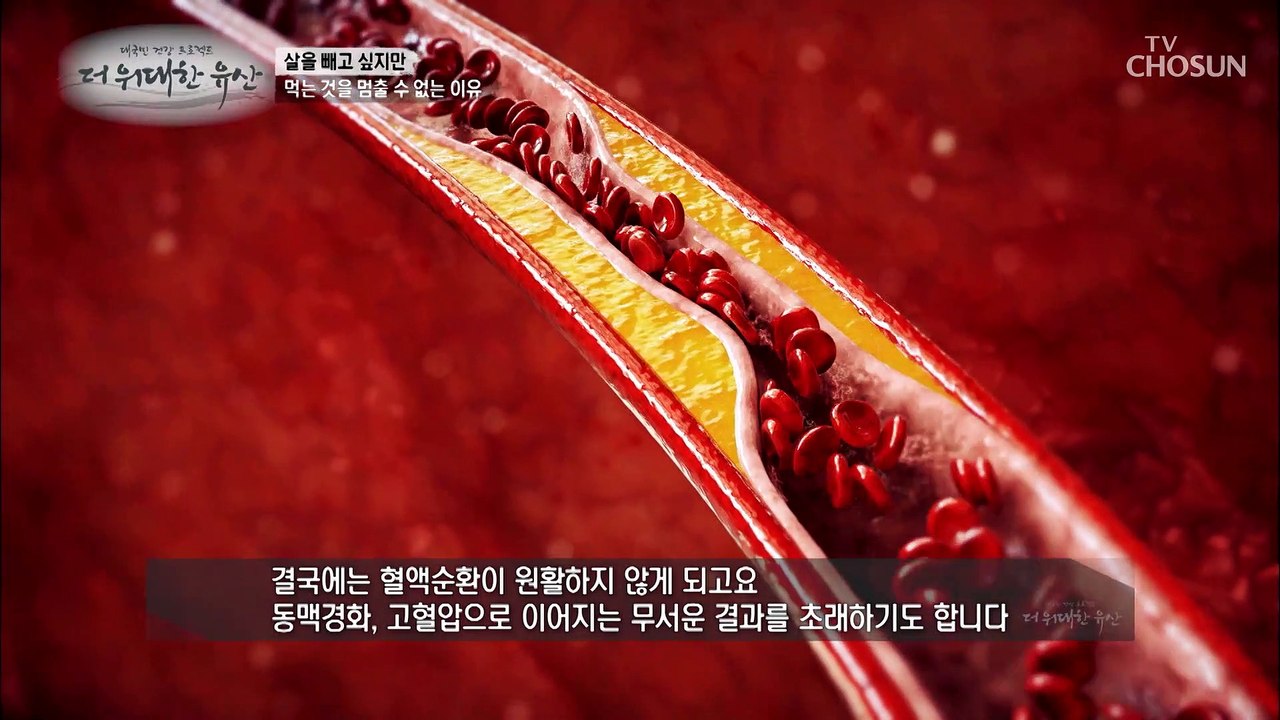 몸속 염증 관리와 호르몬 조절로 살을 뺄 수 있다!? TV CHOSUN 2022080...