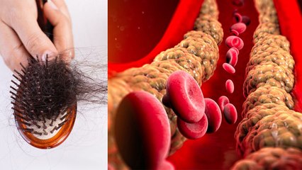 High Cholestrol में Hair Fall होता है क्या,  Expert Advice| Boldsky *Health