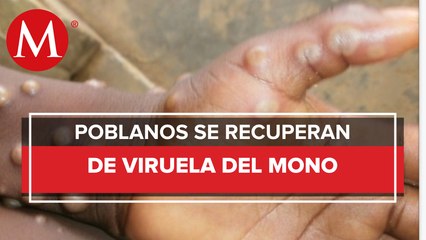 Dan de alta a dos hombres que tuvieron viruela del mono en Puebla