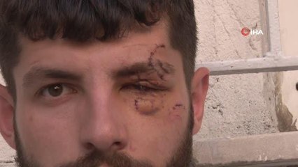 Son dakika haberi: Sigortasız çalıştırılan işçi, sigorta isteyince bardaklı saldırıya uğradı